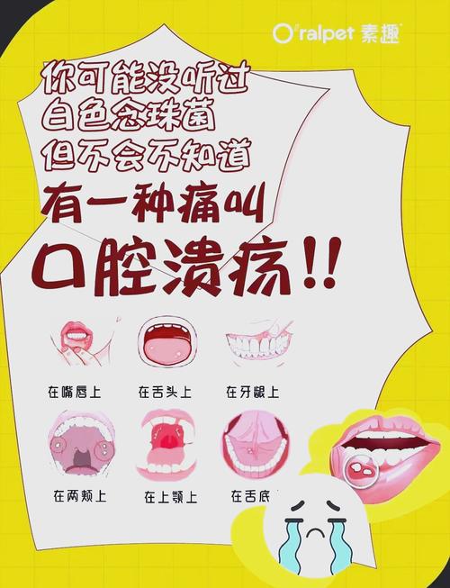 口腔溃疡缺啥维生素?30字疑问标题