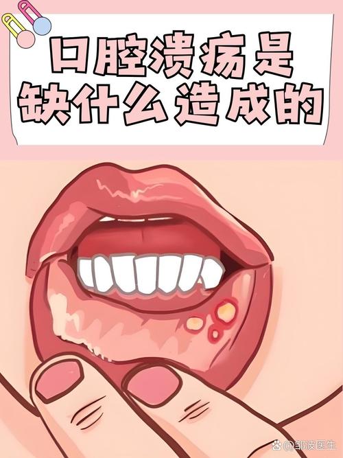 口腔溃疡缺啥维生素?30字疑问标题