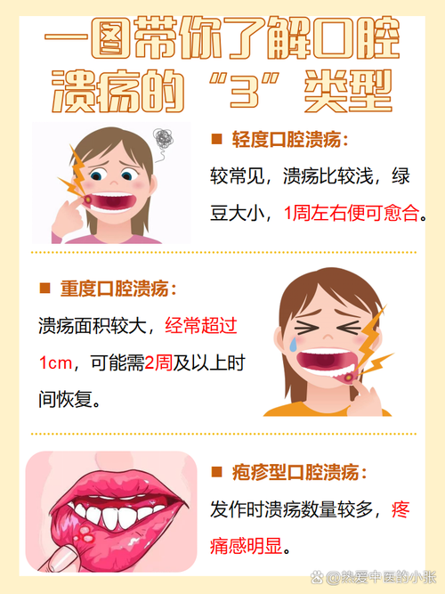 宝宝口腔溃疡怎么办?3个小妙招缓解疼痛?