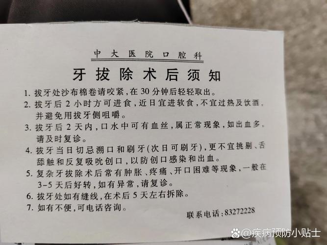 拔牙该挂口腔哪个科?