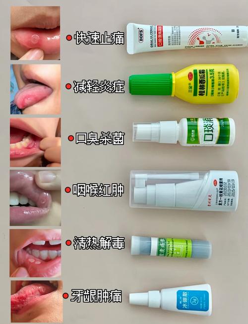 宝宝口腔溃疡,十一个月怎么办?