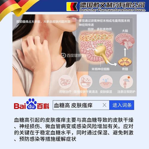 老年人糖尿病皮肤瘙痒用什么药能快速止痒?