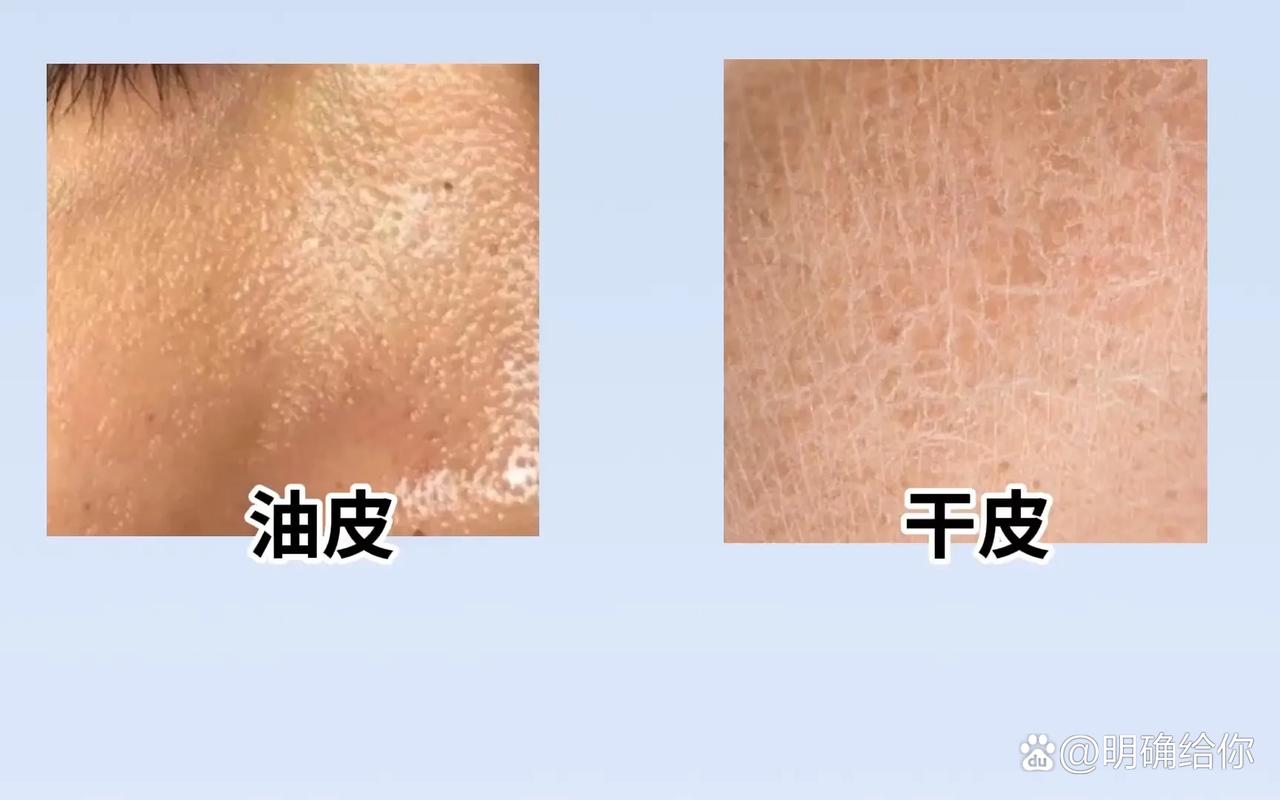 干皮油皮到底哪种皮肤更健康?