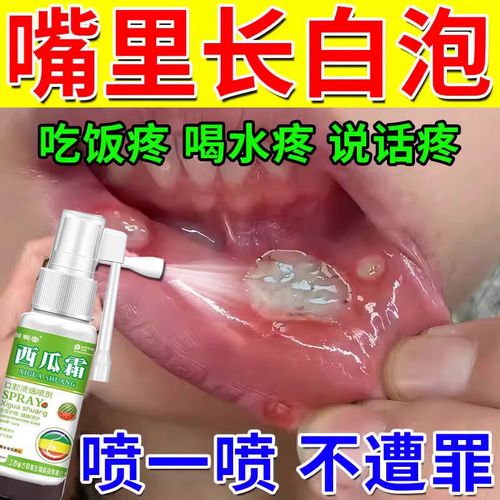 西瓜霜治口腔溃疡效果到底好不好?