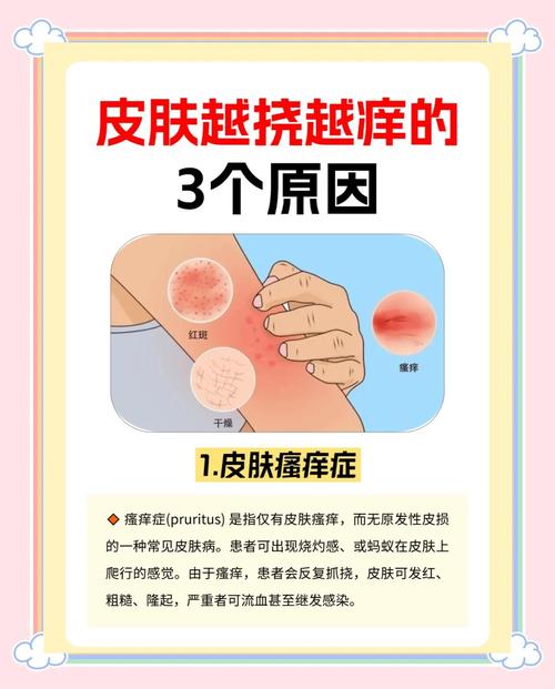 夜间皮肤痒是何原因?