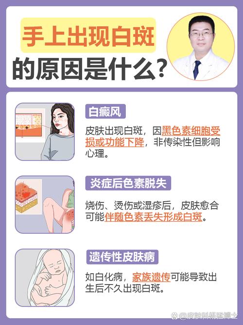 皮肤白色斑点是何原因?