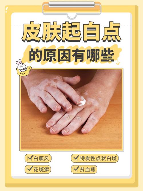 皮肤白色斑点是何原因?