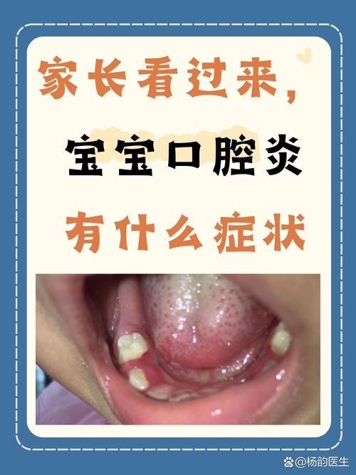 口腔异味重会不会影响孩子