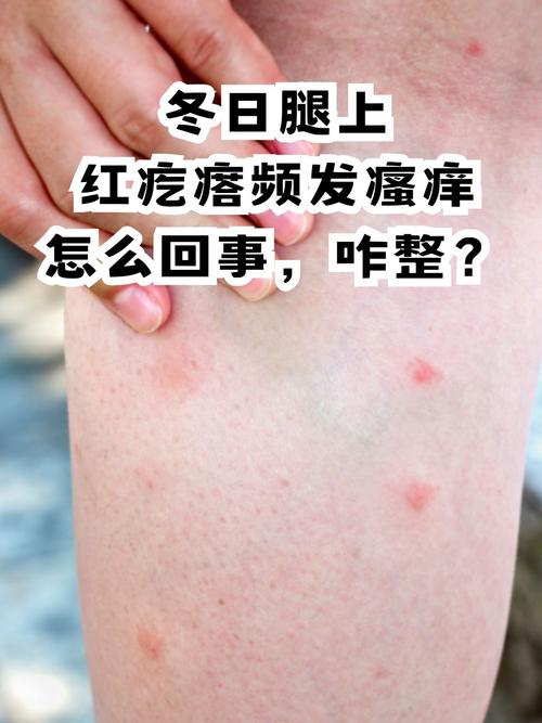 冬天皮肤痒,是缺水还是疾病?