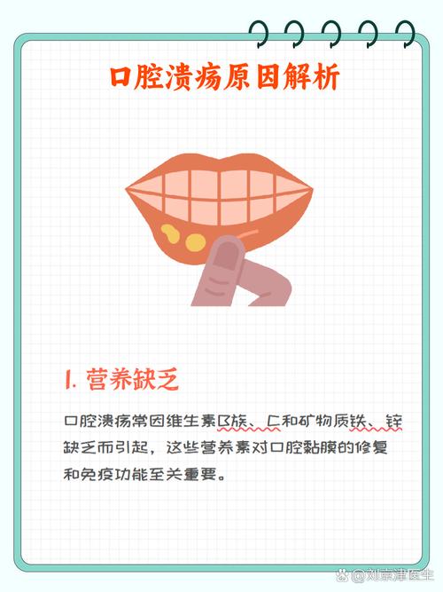 口腔溃疡为何反复发作?