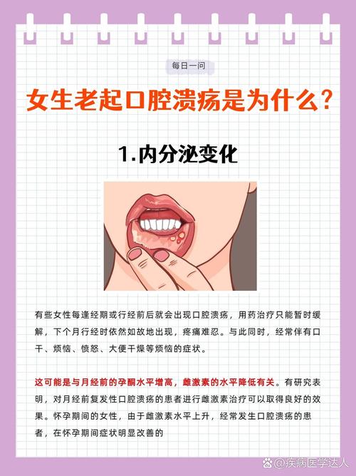 口腔溃疡为何反复发作?