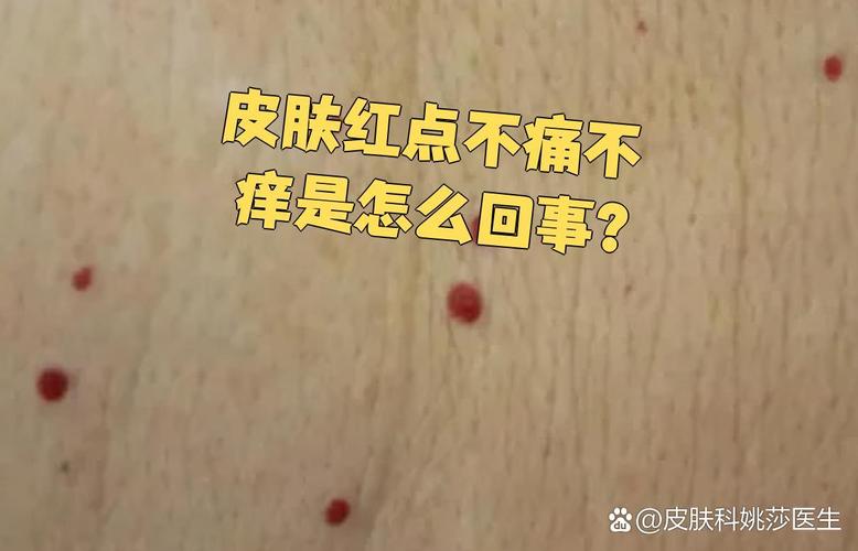 皮肤小红点不痛不痒是何原因?