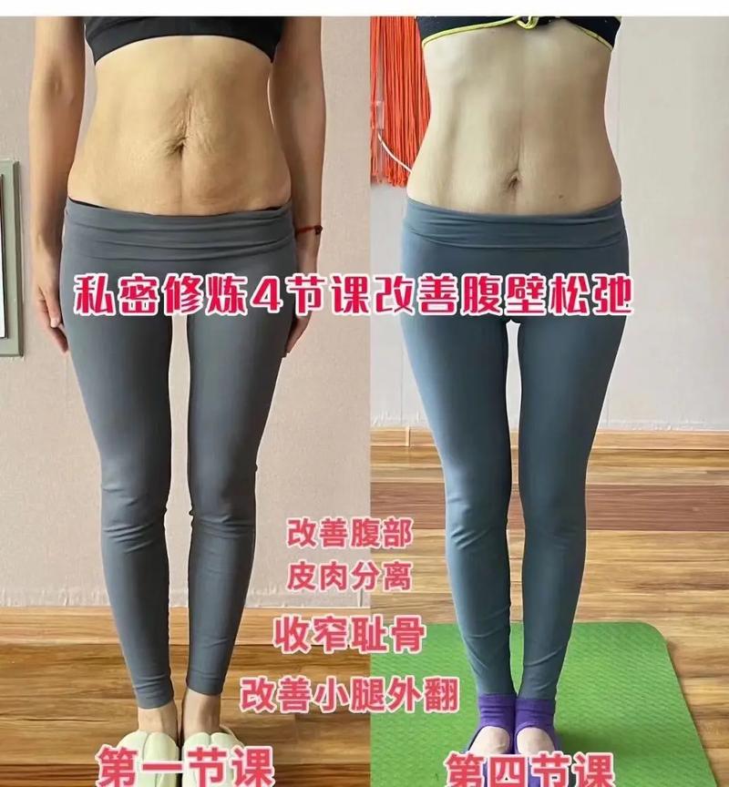 肚子皮肤松弛怎么快速变紧致?