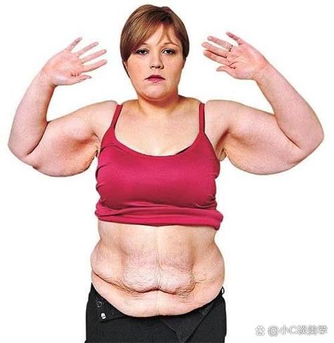 肚子皮肤松弛怎么快速变紧致?