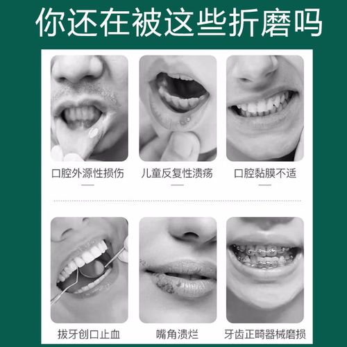 小孩口腔溃疡,选什么药最安全有效?