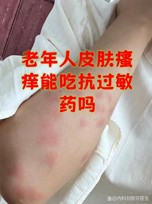 皮肤干燥发痒,如何快速止痒保湿?