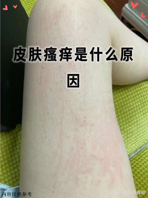 皮肤干燥发痒,如何快速止痒保湿?