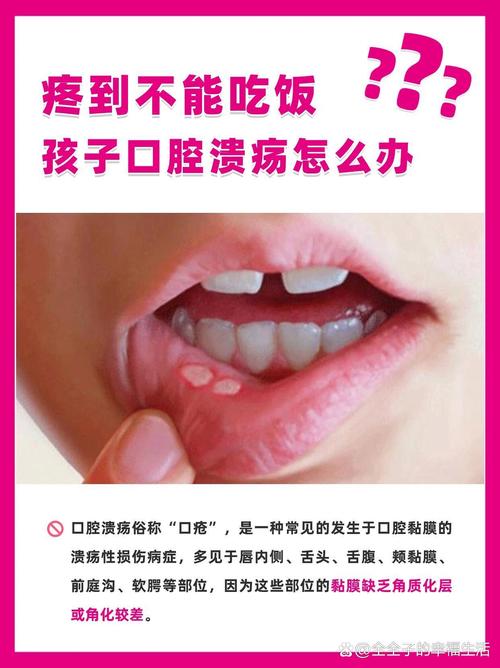 小孩发烧口腔溃疡怎么办?