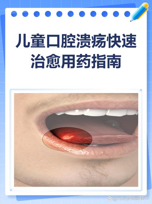 小孩发烧口腔溃疡怎么办?