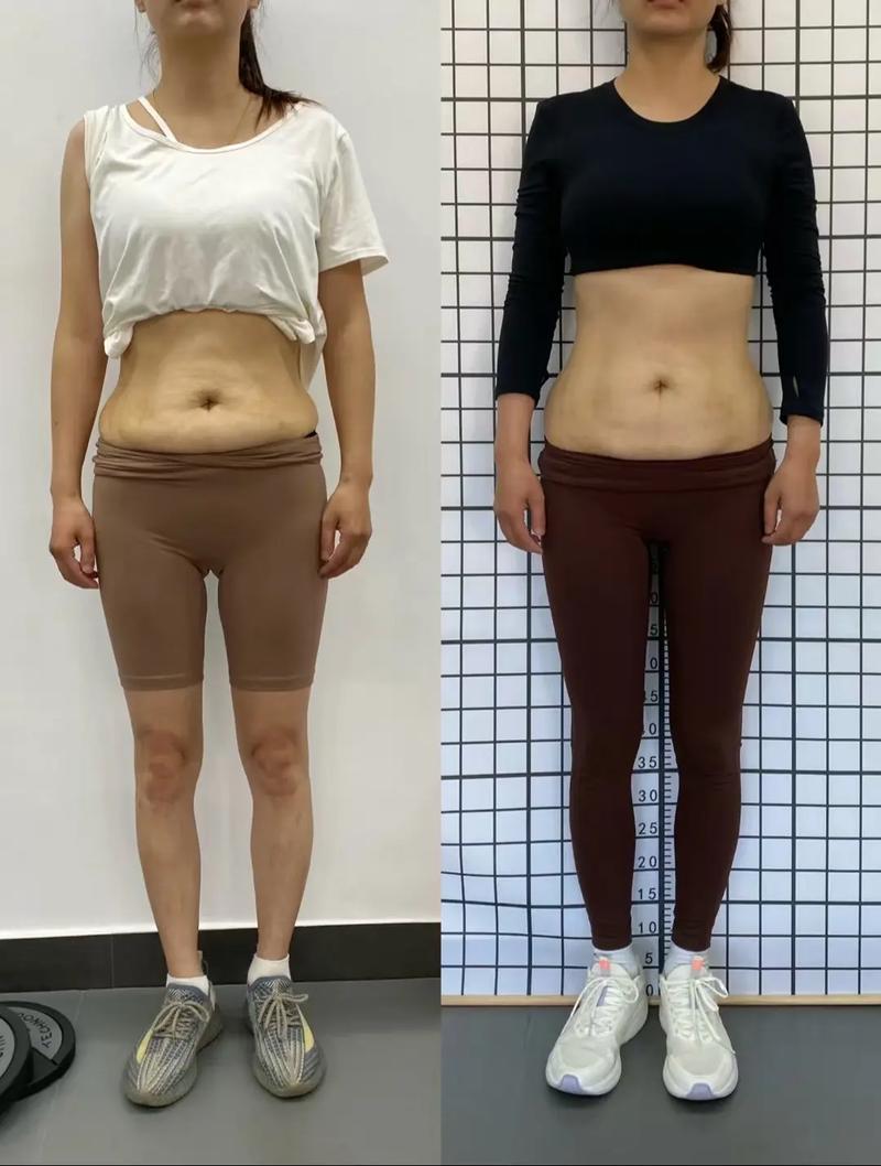 减肥后皮肤松弛,如何有效紧致?