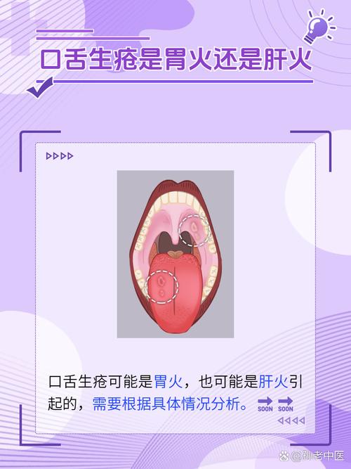 口腔反复上火,是身体哪里出问题了吗?