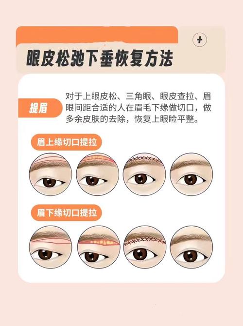 眼睛松弛怎么办?