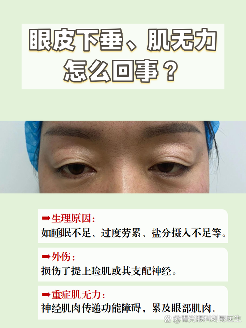 眼睛松弛怎么办?