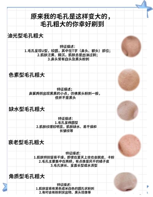 皮肤干燥毛孔粗大,怎么破?