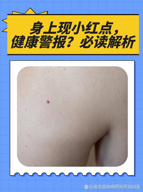 皮肤红点是何原因引起?