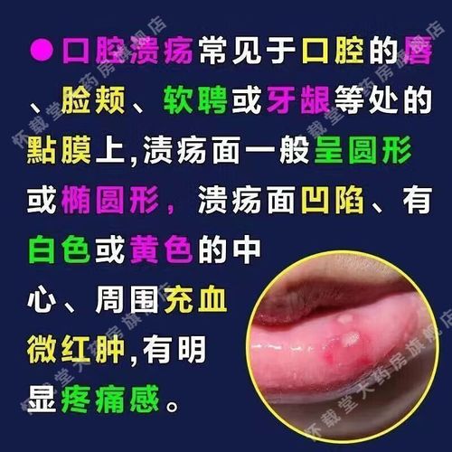 口腔溃疡吃维生素C有用吗?