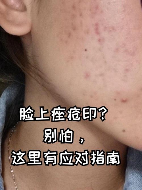 皮肤基底层炎症如何有效解决?