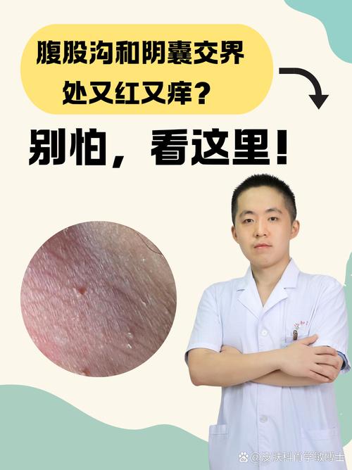 皮肤痒吃维生素B2还是B12更有效?