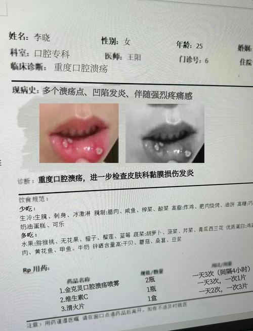 孩子口腔溃疡是什么原因