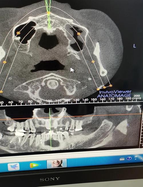 口腔CBCT检查费用一般是多少?
