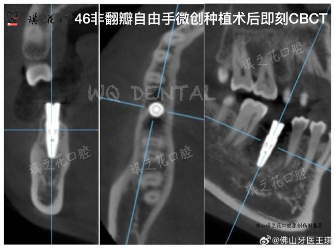 口腔CBCT检查费用一般是多少?