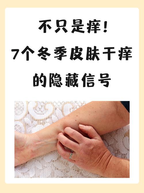 冬天皮肤干痒怎么办?