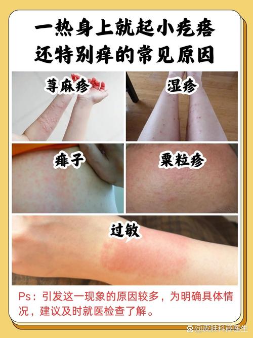 全身皮肤瘙痒是何原因引发?