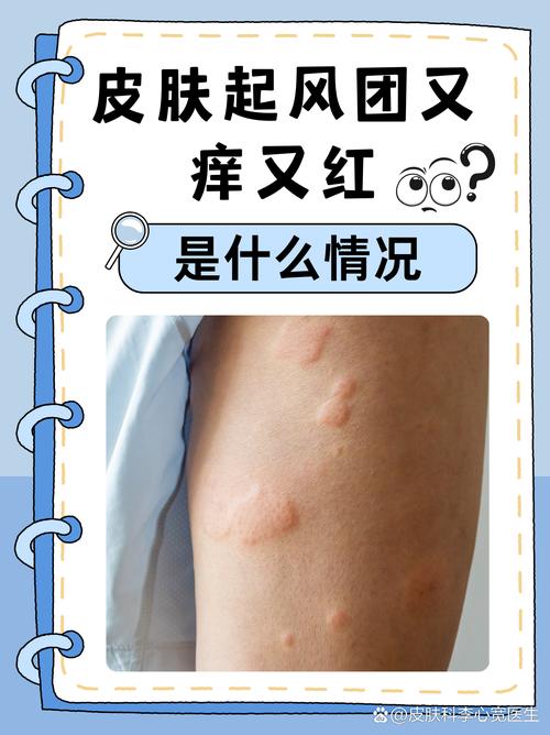 全身皮肤瘙痒是何原因引发?