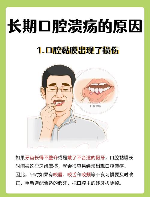 口腔溃疡痛难忍,咋快速止痛?