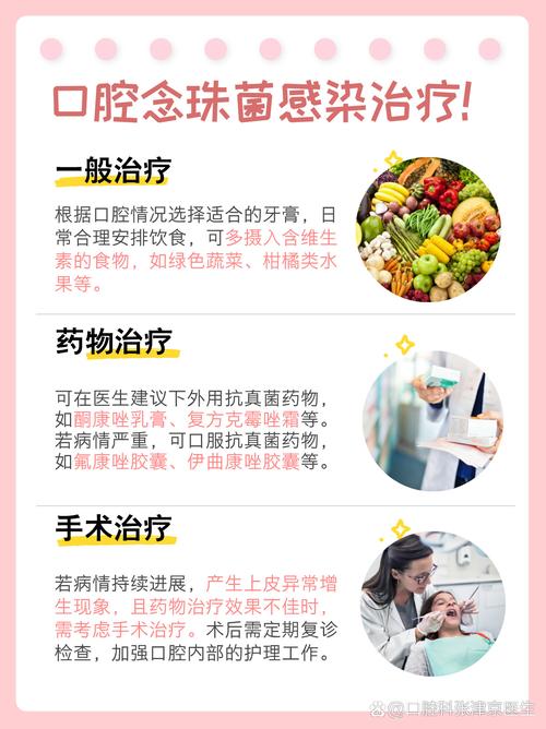 口腔念珠菌感染怎么治疗