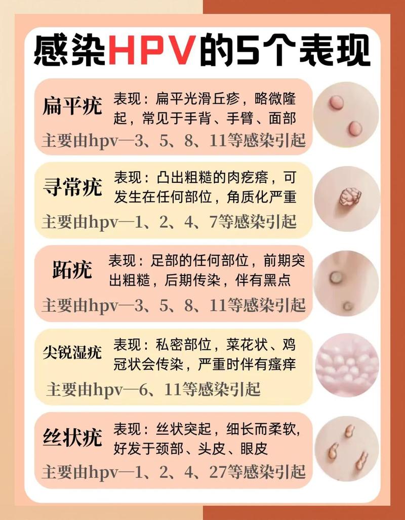 皮肤接触会感染HPV吗?