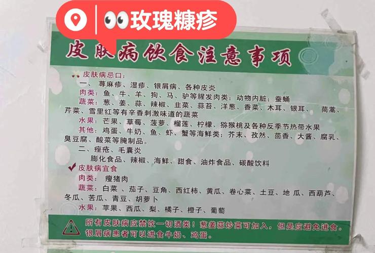神经性皮炎患者哪些食物碰不得?