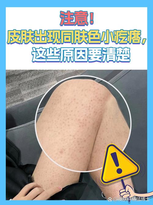 皮肤差是哪些内脏在报警?