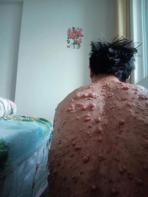 狗狗真菌感染皮肤病图片如何辨别?