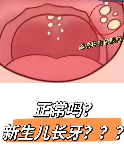 四个月宝宝口腔白点是鹅口疮吗?