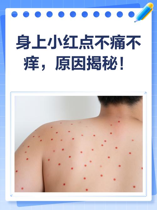 皮肤小红点像血点,是啥问题?