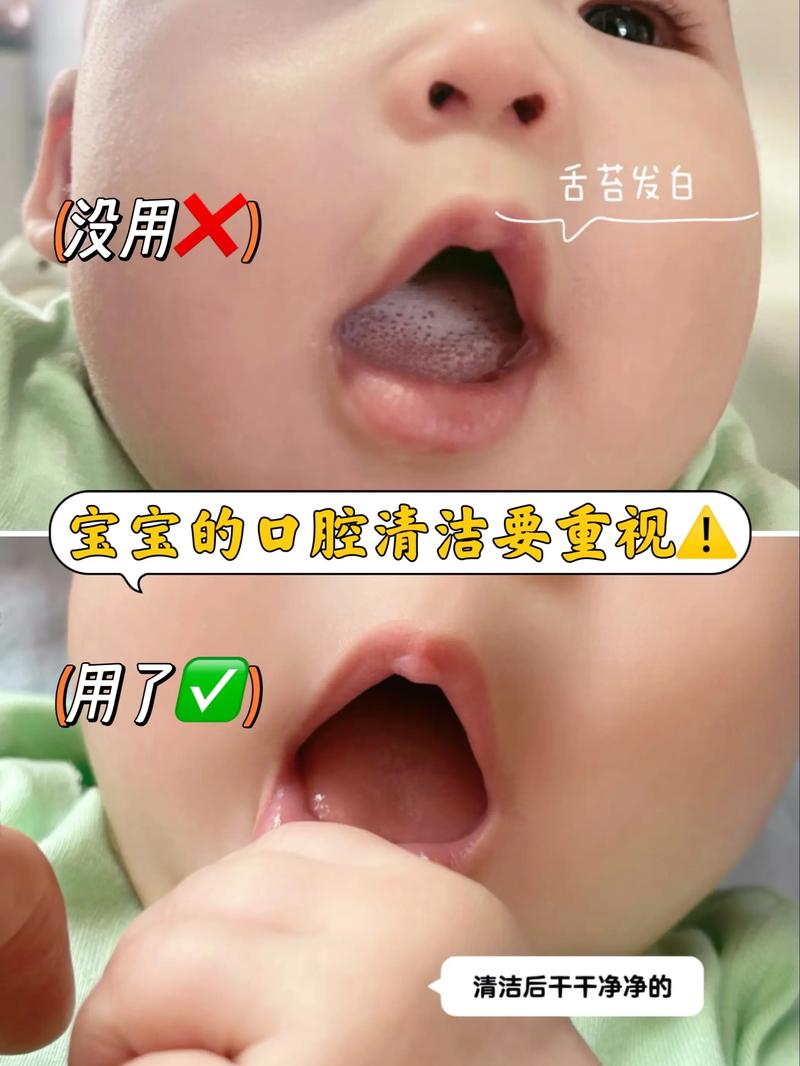 三个月宝宝口腔清洁怎么做?