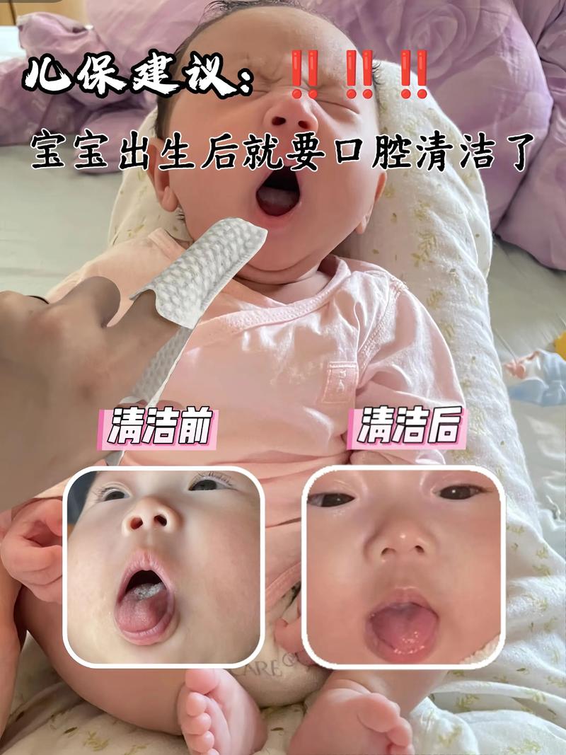 三个月宝宝口腔清洁怎么做?