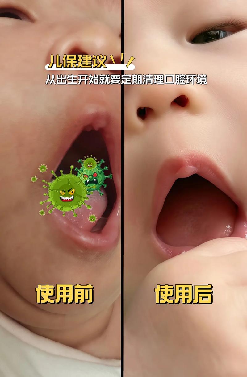 三个月宝宝口腔清洁怎么做?