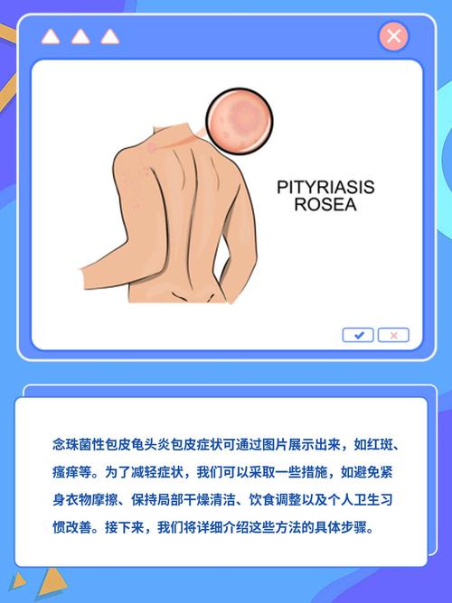 龟头炎挂皮肤科对吗?